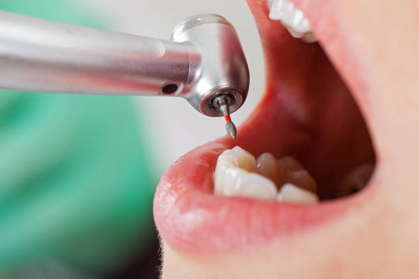 Best Urgent Dental Care for Toothache in Kerens, TX